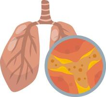 enfermedad pulmonar. obstrucción del canal. moco en los alvéolos. problemas respiratorios. vista ampliada bajo el microscopio. bronquios y bronquitis. material médico educativo plano. vector