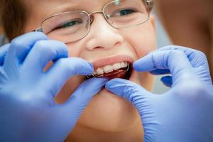 Little Boy At The Dentist photo