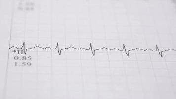 électrocardiogramme ecg ou ekg sur papier video