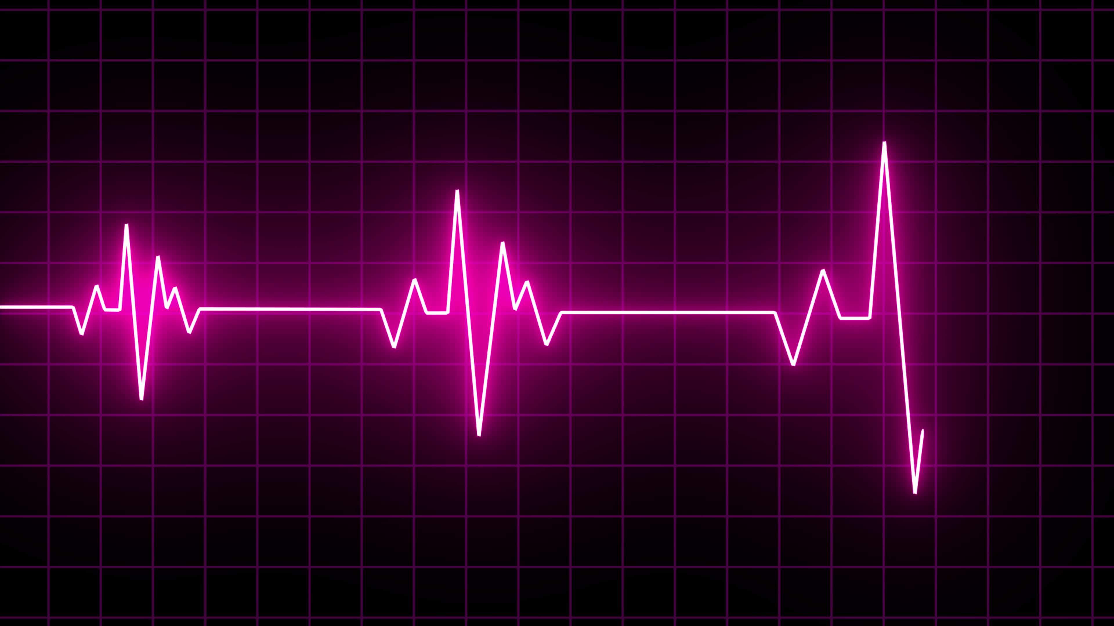 Neon Digital Heartbeat Plus Animation Over Black Bg, Heart Beat Line  Cardiogram Medical Background, Ekg Ecg Heartbeat Line Animation, Glowing  Neon Heart Rate Line Video Animation On Black Screen 14195482 Stock Video