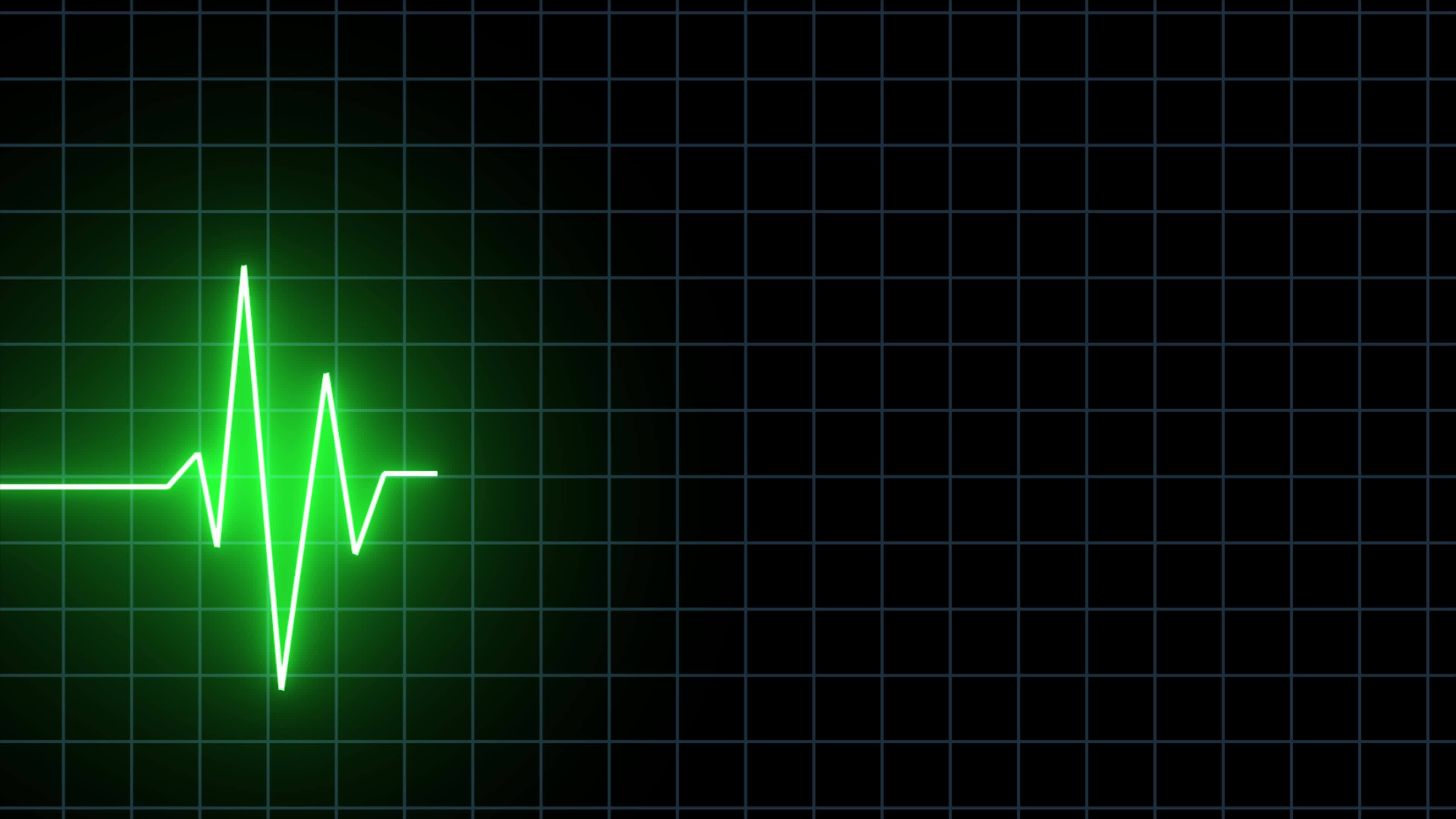 Neon Digital Heartbeat Plus Animation Over Black Bg, Heart Beat Line  Cardiogram Medical Background, Ekg Ecg Heartbeat Line Animation, Glowing  Neon Heart Rate Line Video Animation On Black Screen 14195494 Stock Video