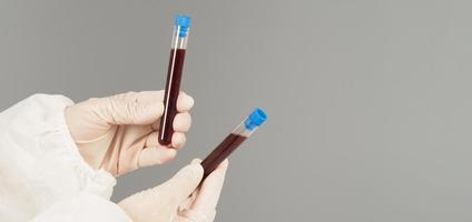 Hands are holding two blood test tubes on grey background. Hand wears a PPE suit and a white medical glove. photo