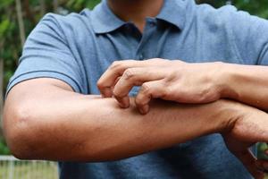 man suffering from itching skin, close up. photo