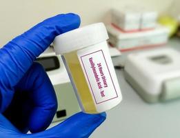 Urine sample for VMA or Vanillylmandelic acid Test, used to detect neuroblastomas and neuroendocrine tumors. photo