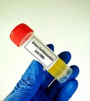 Urine sample for 24 hours Vanillylmandelic acid or VMA Test for the detection neuroblastomas and neuroendocrine tumors. photo