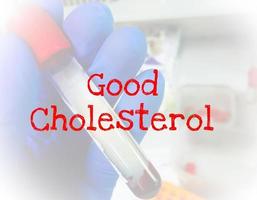 Good Cholesterol term with laboratory background. medical conceptual image. photo