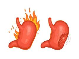 Diseases of the human stomach. Heartburn and ulcer. Internal organ, anatomy, medicine. Vector illustration isolated on white background.