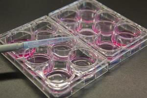 Cell Culture or Tissue culture photo