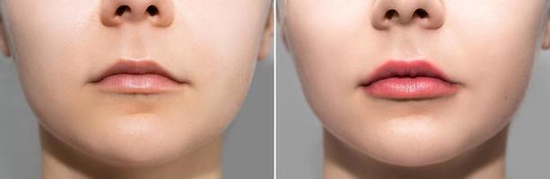 Female lips after permanent makeup lip blushing procedure photo