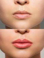 Female lips after permanent makeup lip blushing procedure photo