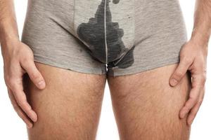 Man with wet briefs because of urinary incontinence photo