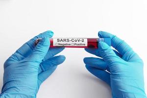 Scientist hand with a blood sample of SARS-CoV-2 photo