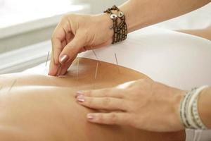 Master is injecting steel needles during procedure of acupuncture therapy photo