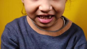 Young girl smiles with baby and adult teeth video