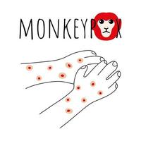 Monkeypox virus symptom doodle concept. Monkey face and hands with rash. Monkey pox script. Viral smallpox disease. Vector illustration.