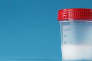 A container for biomaterials with sperm analysis and a red lid on a blue background. photo