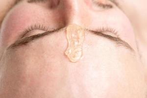 Liquid wax between the eyebrows of a young man photo