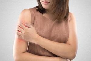 Asian women who are itching from insect bites against gray wall background photo