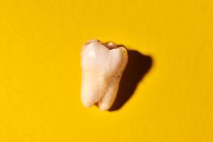 Wisdom tooth with tooth decay, yellow background photo