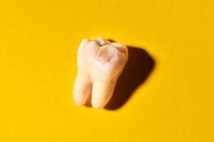 muela del juicio con caries, fondo amarillo foto