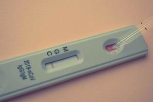 Covid-19 Virus Disease Test, Coronavirus Crisis, Global Pandemic Outbreak, Rapid Strep Test Rst photo