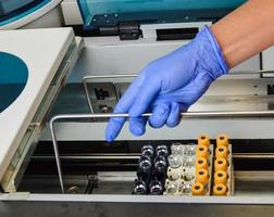 a doctor of laboratory diagnostics puts test tubes with multi-colored caps into the analyzer to perform laboratory tests. health diagnostics with the help of tests photo