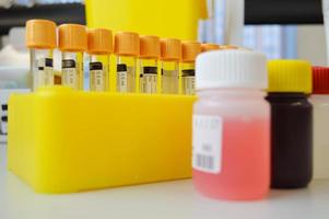 tubes in the holder next to liquid reagents for performing research. laboratory tests to detect diseases. venous blood tests under sterile conditions photo