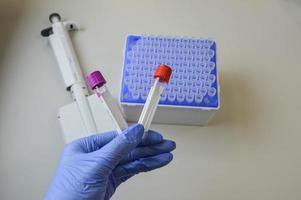 a doctor in a blue glove holds in his hand two test tubes for performing analyzes with multi-colored caps. against the background of a mechanical dispenser for performing analyzes. laboratory photo