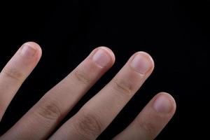cuatro dedos de una mano humana vistos parcialmente a la vista foto