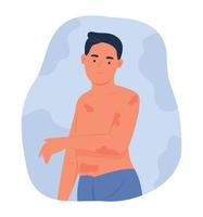 hombre con dermatitis atópica o eczema en el cuerpo vector