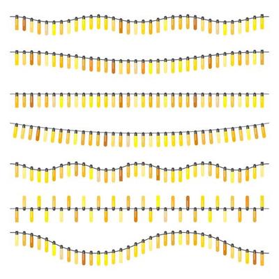 Garland with yellow light bulbs on a white background. Vector illustration.