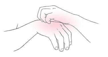 Have a itching, Concept with Healthcare And Medicine, 2D Animation video
