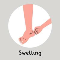 Swelling of the feet, edema. By pressing a finger a dent appers. vector