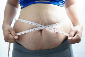 mujer obesa necesita control de peso, tiene exceso de grasa. foto