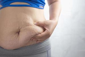 Obese woman needs weight control, she has excess fat. photo