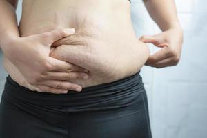 mujer obesa necesita control de peso, tiene exceso de grasa. foto