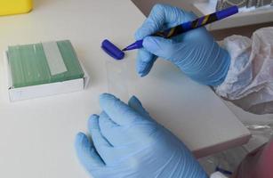 close up of scientist hand with test sample in lab photo