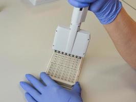 mechanical dispenser for performing laboratory tests. tips for performing blood tests. setting up material for performing tests by ELISA photo