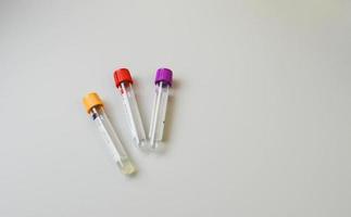 Test tubes rack with madical samples on the table at the modern laboratory photo