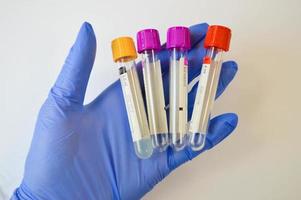 Bacteria test on laboratory test tube in the analyst's hand in a plastic glove photo