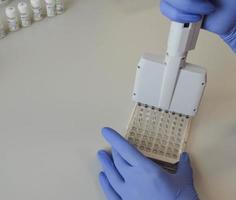 a doctor in blue, disposable, nitrile gloves performs a laboratory analysis by an immunoassay method. a blood test from a vein. portable pipette for handling liquids photo