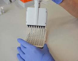 Scientist in a medical laboratory with a dispenser in his hands is doing an analysis photo