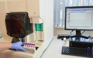 the doctor puts test tubes into the analyzer to perform research. analysis data is displayed on the monitor. laboratory diagnostics, sterile conditions photo