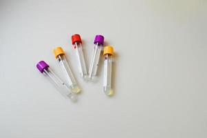 Test tubes with blood samples on table in laboratory. Virus research photo