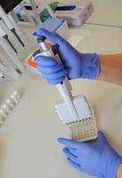 un médico con guantes azules de nitrilo desechables realiza un análisis de laboratorio mediante un método de inmunoensayo. pipeta de diagnóstico de laboratorio mecánico foto