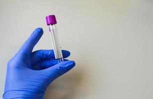 Hand with glove handling a Covid-19 test tube photo