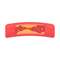 artérias coronárias com gordura acumulada no corpo png