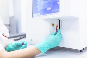 Lab technician holding blood in EDTA tube for test complete Blood Count testing hematology laboratory. Scientific medical test with automated hematology analysis. photo