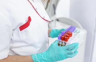 hand of a lab technician holding blood tubes test and background a rack of color tubes with blood samples other patients   laboratory technician holding a blood tube test photo