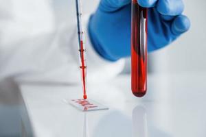 vista de cerca del médico en bata de laboratorio que funciona con un tubo de ensayo con sangre dentro